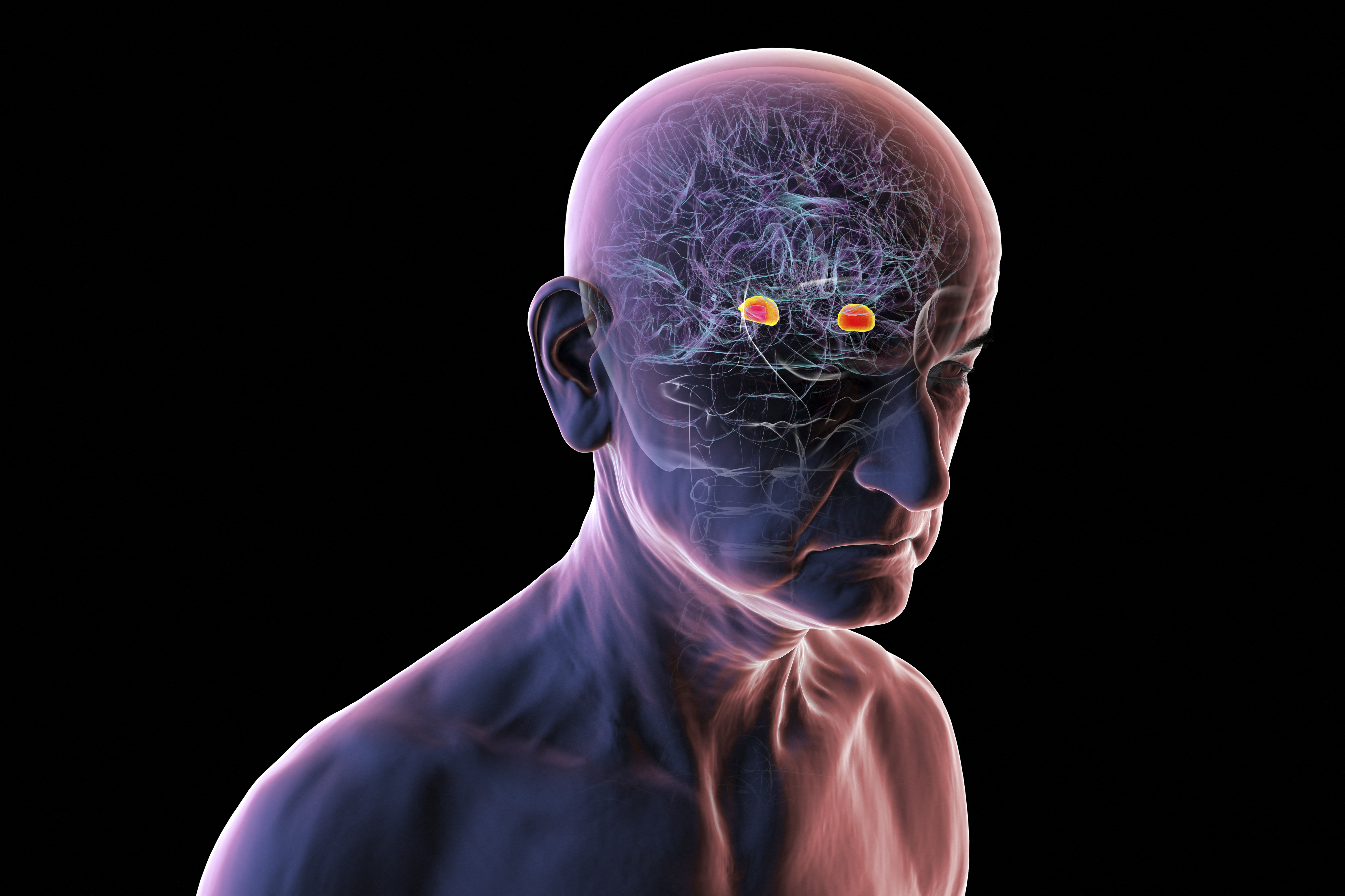 Common cause for loneliness: Call for volunteers to spend time with people living with dementia