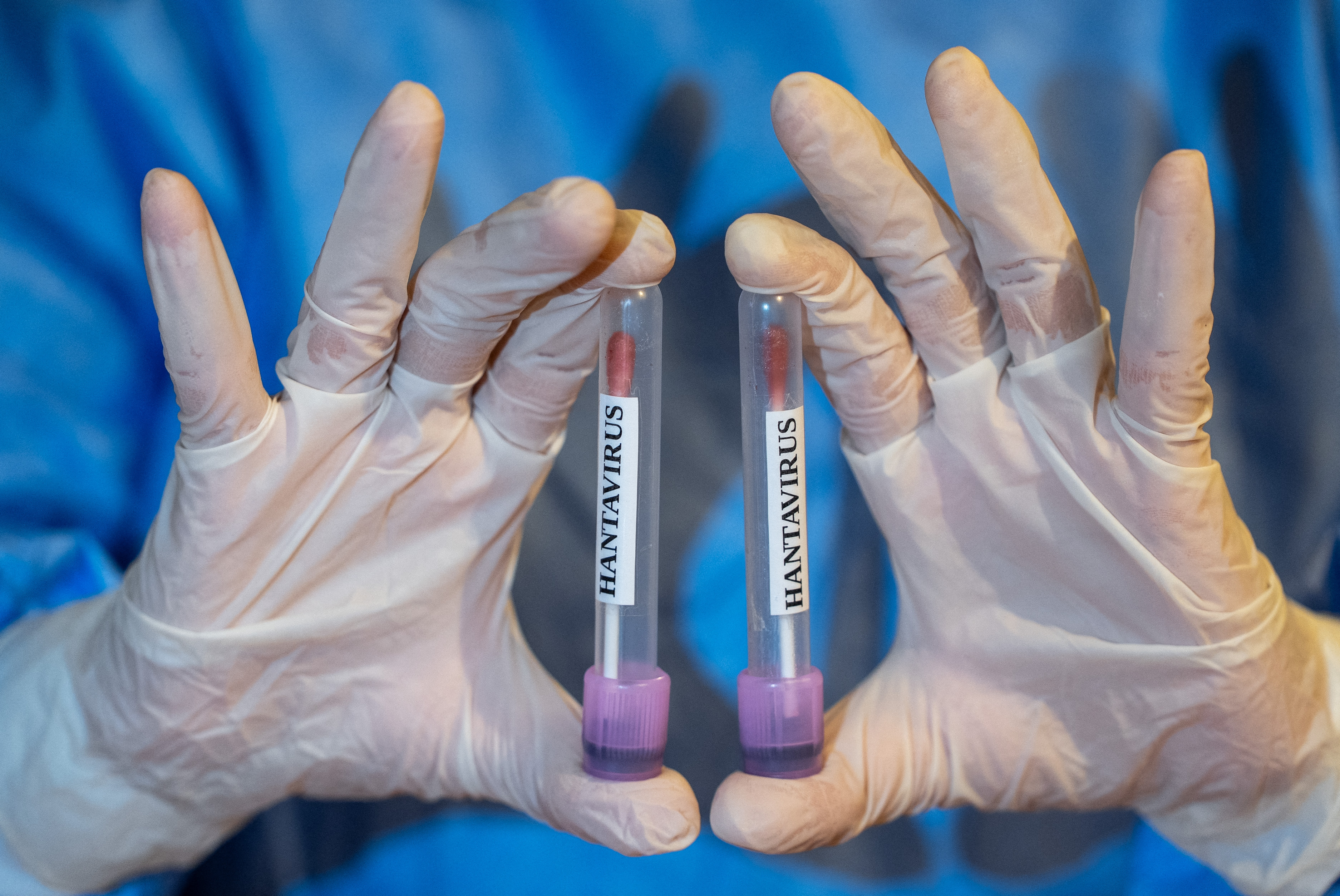 Är Äntwerten op d'Wochenëmfro: Hantavirus & Europdag