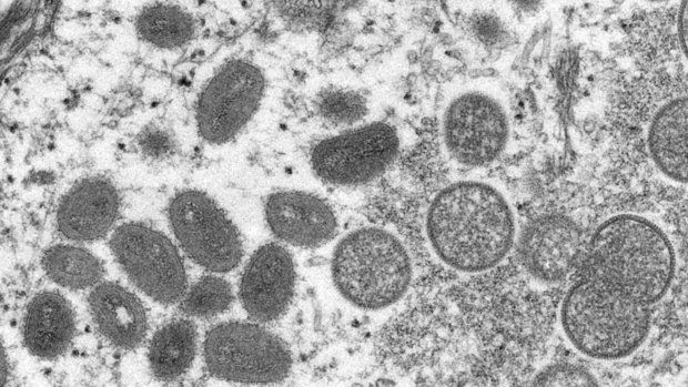 US-Parquet ermëttelt: Zwee Fuerscher sollen illegal Mpox-Viren an d'USA importéiert hunn