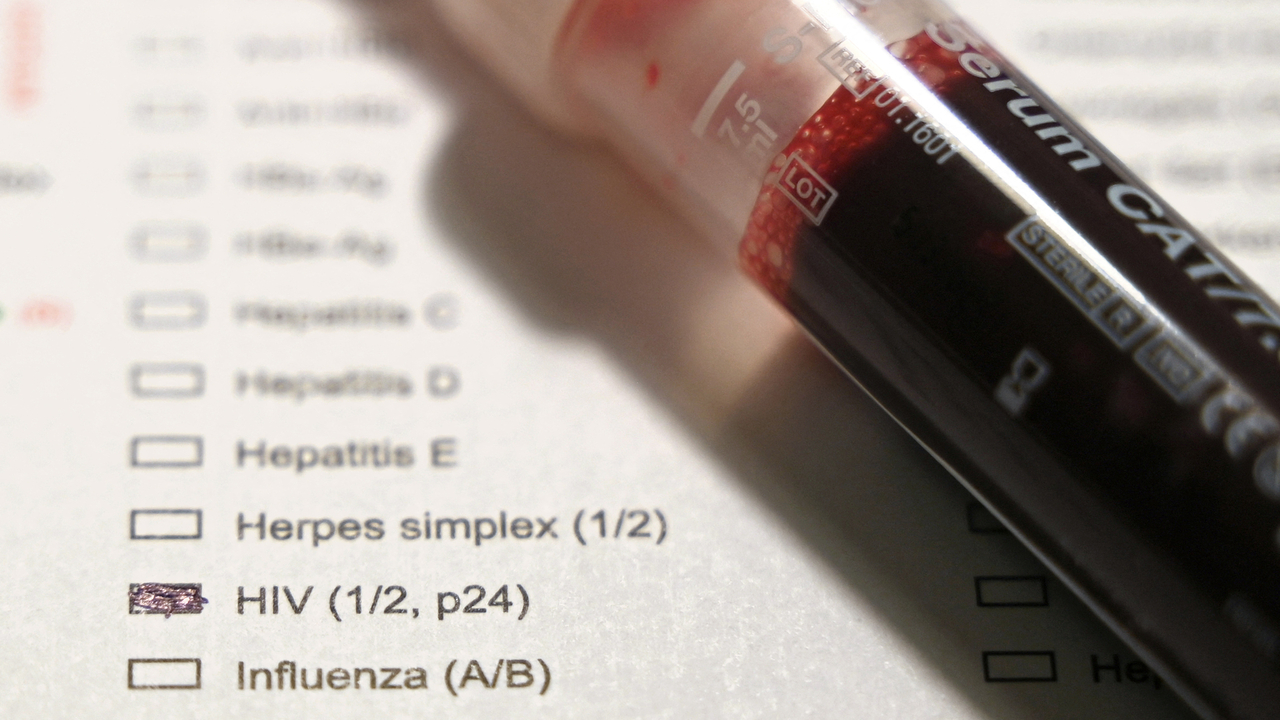 World AIDS Day: World AIDS Day: Around 60 cases of HIV assumed to go unnoticed in Luxembourg