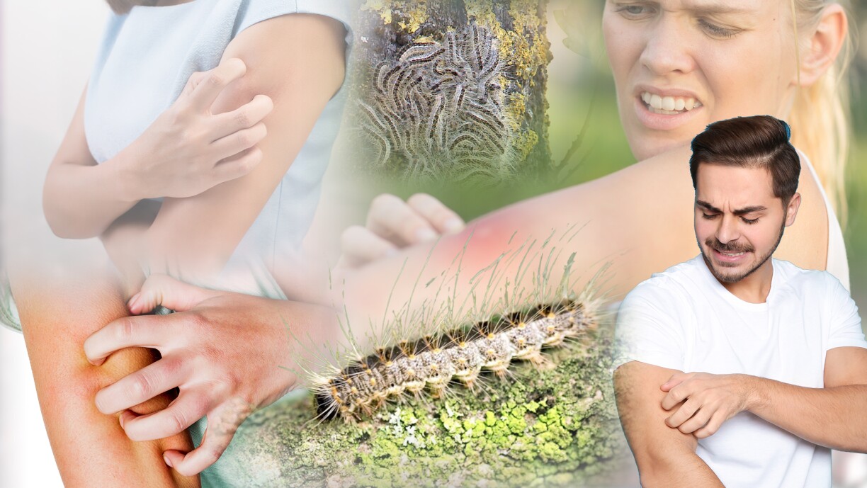 Les chenilles processionnaires sont en pleine expansion depuis des années, et pour l'instant, on ne sait pas faire grand chose pour combattre ce phénomène.