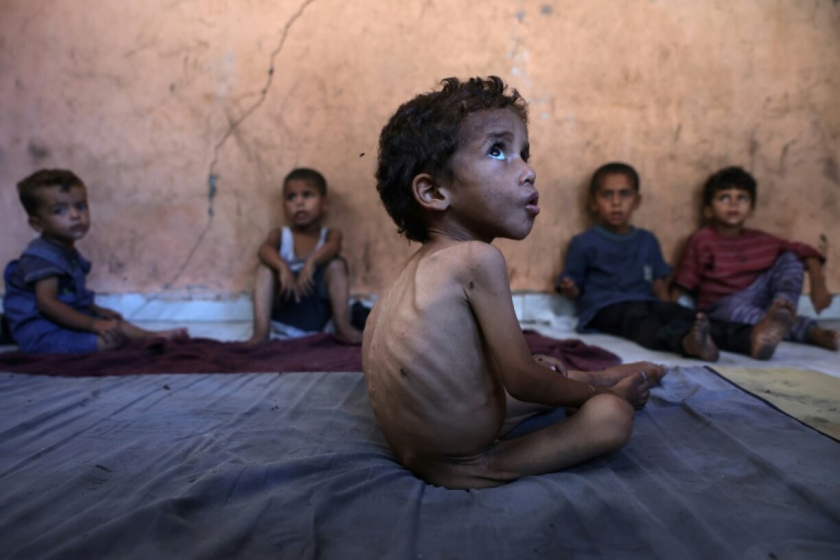 Gaza is suffering 'man-made... mass starvation', according to the head of the World Health Organization, Tedros Adhanom Ghebreyesus