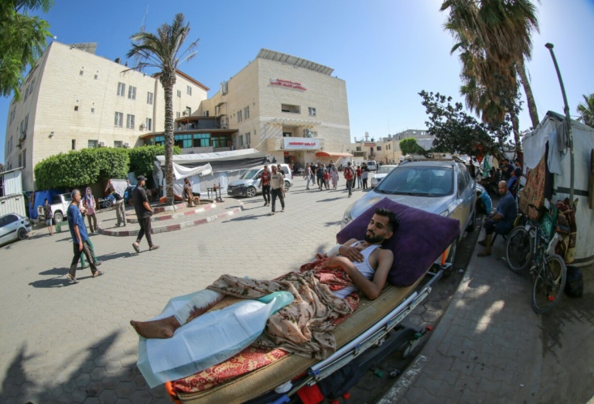 Un homme blessé photographié le 7 juin 2024, à l'extérieur d'un hôpital à Deir al-Balah, dans le centre de la bande de Gaza, pendant la guerre entre Israël et le Hamas