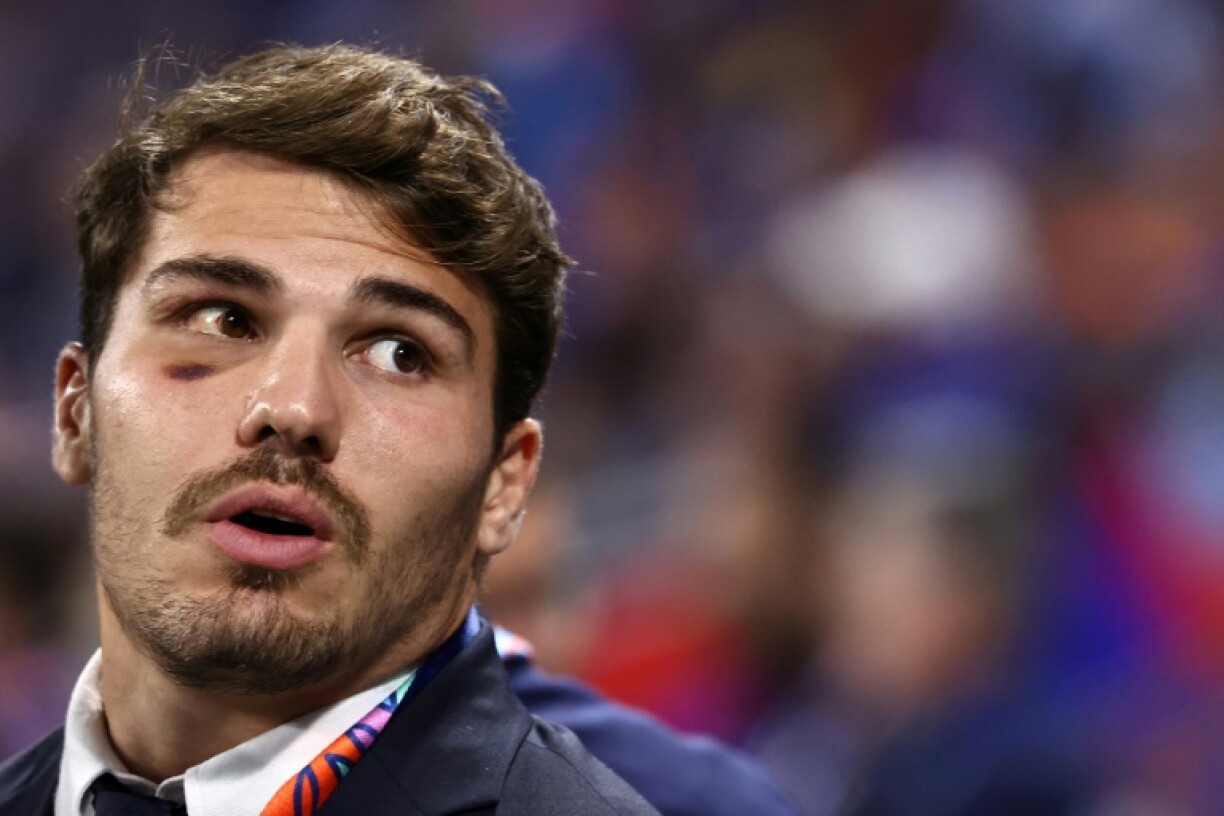 Le demi de mêlée du XV de France, Antoine Dupont, qui a été autorisé à reprendre les entraînements par son chirurgien, le 6 octobre 2023 à Lyon lors du match France-Italie