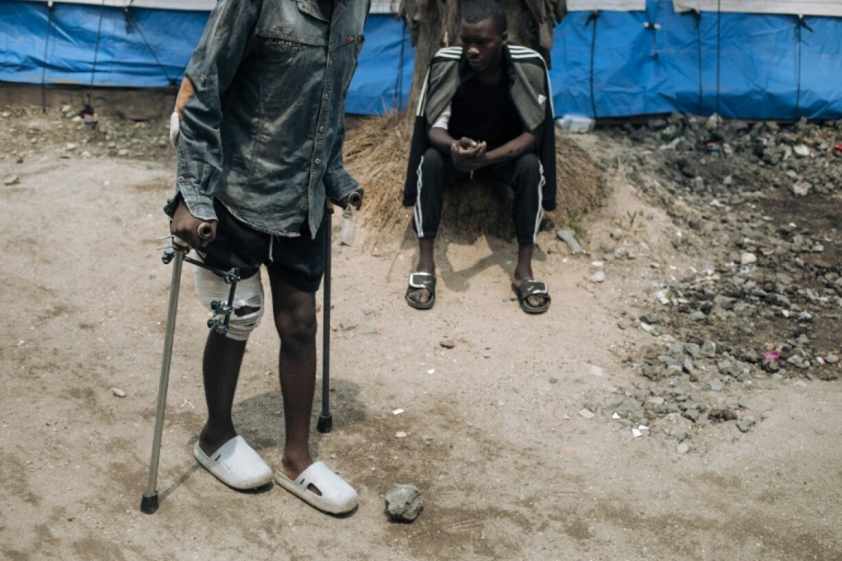 A man wounded during recent clashes in Goma