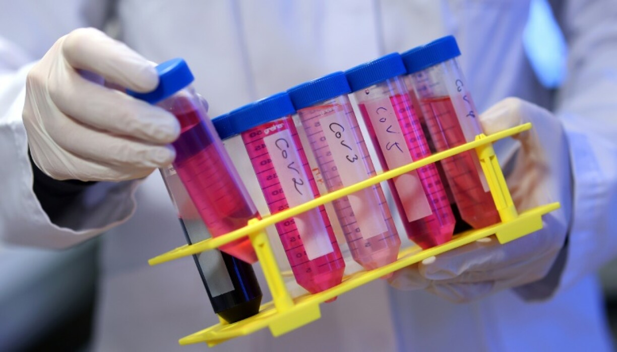 Vacciné 217 fois contre le Covid sans effet secondaire: le cas d'un Allemand étudié par des scientifiques