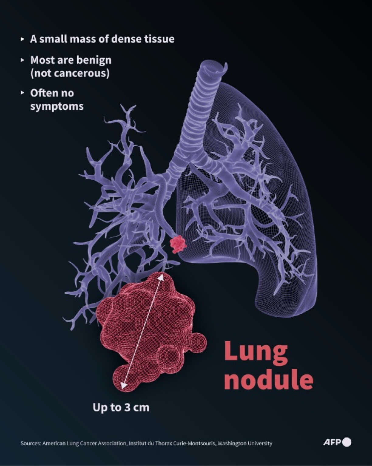 A lung nodule
