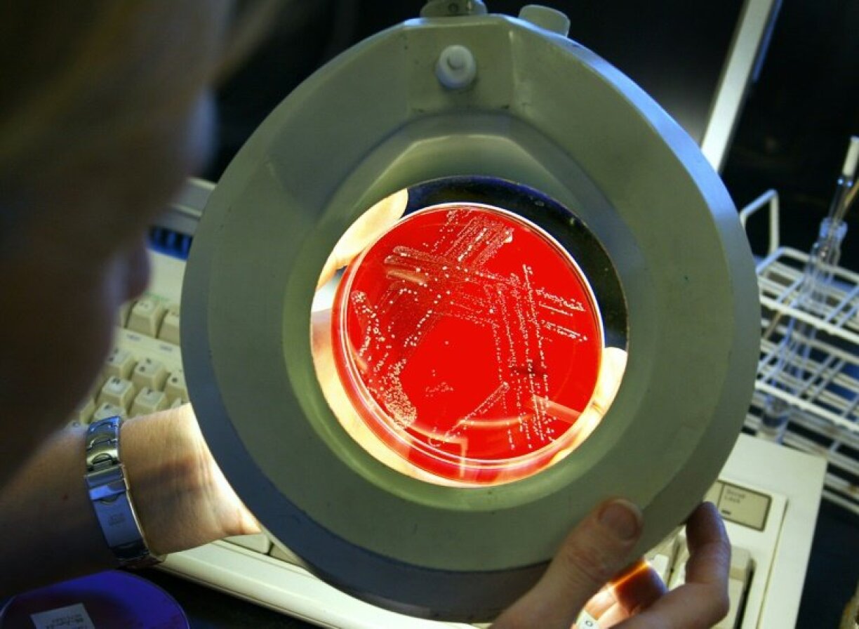 Antibiotic resistance happens when bugs become immune to existing drugs, like antibiotics, and make minor injuries and common infections potentially deadly.