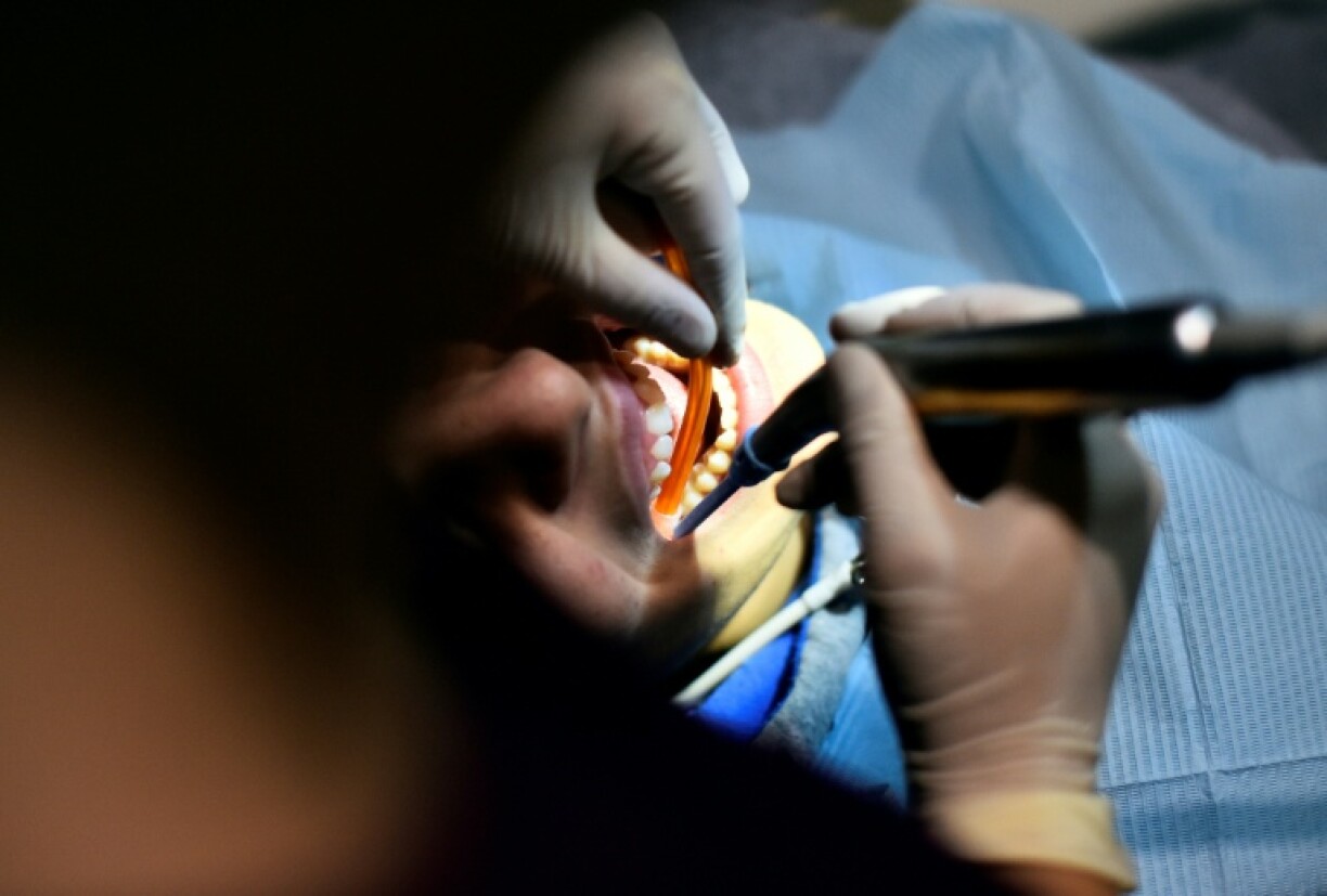 Un ex-dentiste de 61 ans comparaît devant le tribunal correctionnel de Mende (Lozère), accusé d'avoir escroqué la sécurité sociale en pratiquant des opérations médicalement injustifiées et bâclées ayant occasionné des mutilations chez des dizaines de ses patients