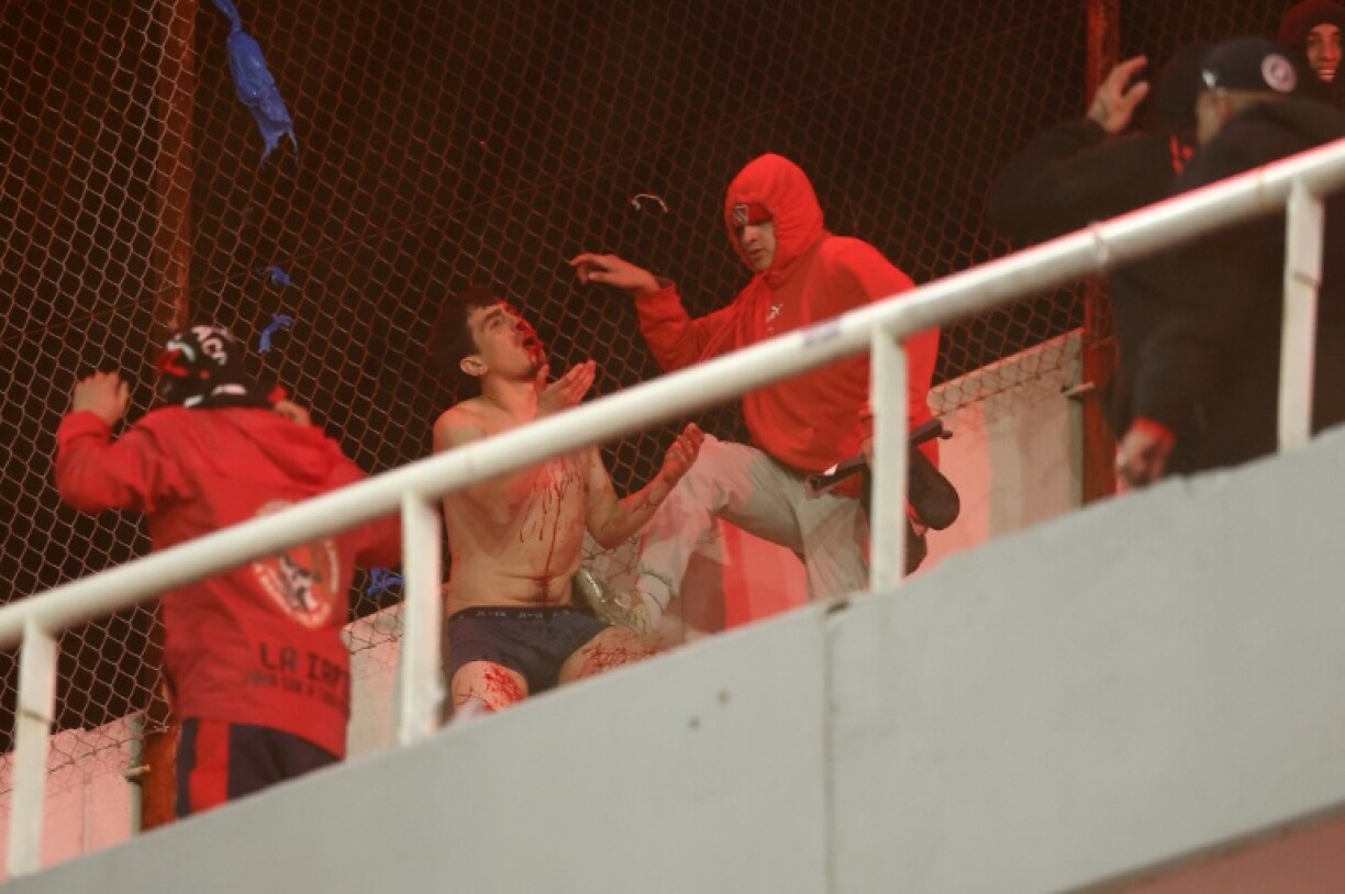 A fan of Universidad de Chile bleeds while being hit by fans of Independiente during the interruption of the Copa Sudamericana round of 16 second leg football match between Argentina's Independiente and Chile's Universidad de Chile at the Libertadores de America stadium in Avellaneda, Buenos Aires province, Argentina, on August 20, 2025.