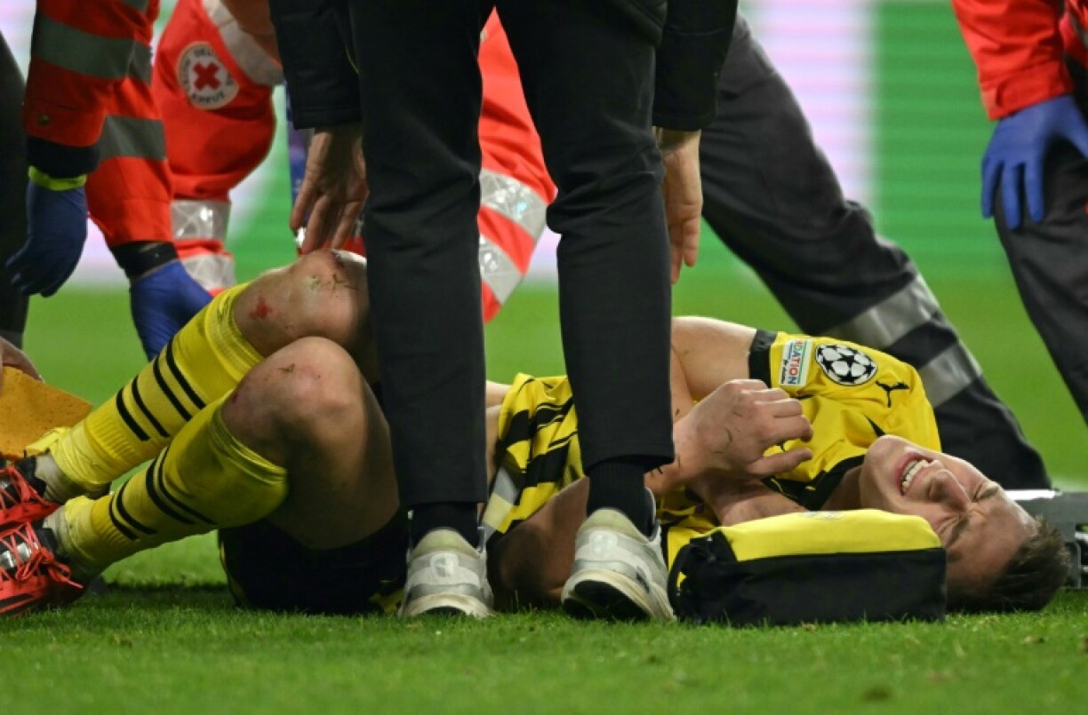 Borussia Dortmund defender Nico Schlotterbeck was stretchered off the pitch with an apparent ankle injury