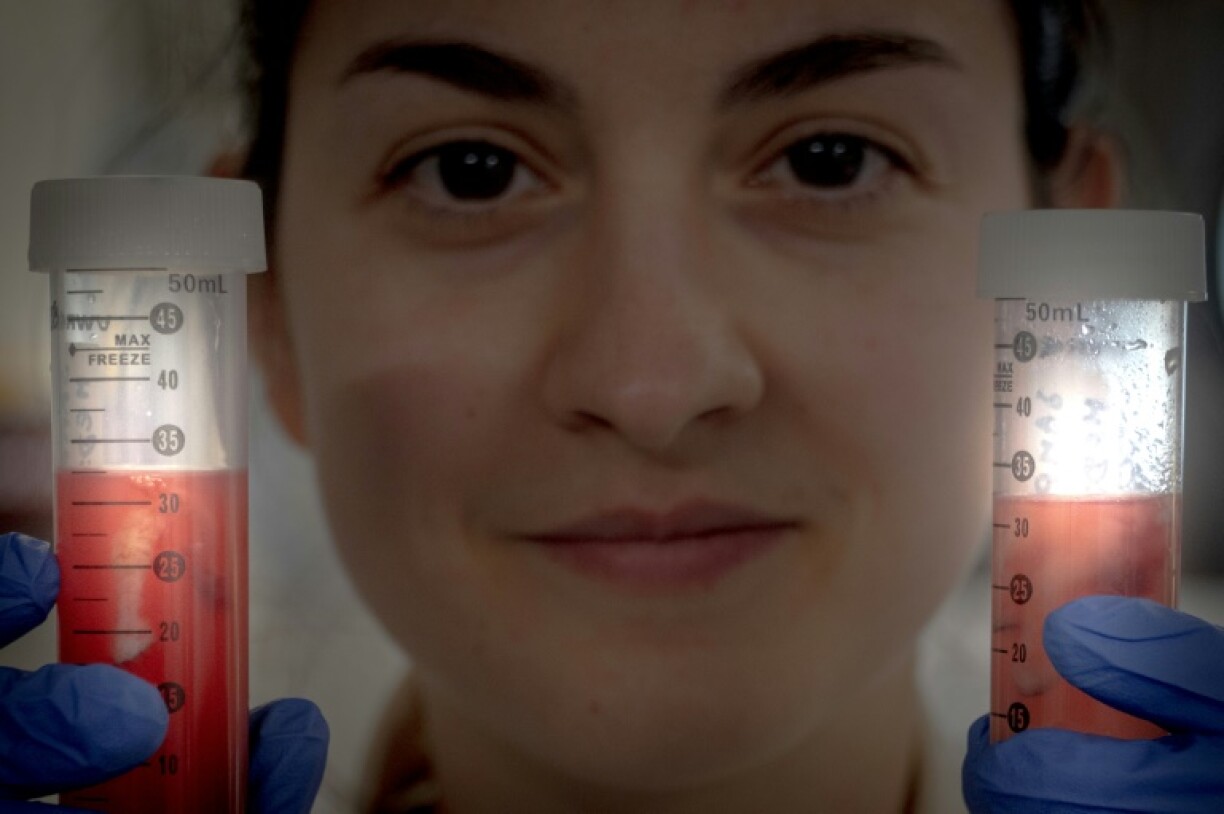 Belgian toxicologist Laura Pirard with samples of fat taken from polar bears and tested using the new 'slice' method