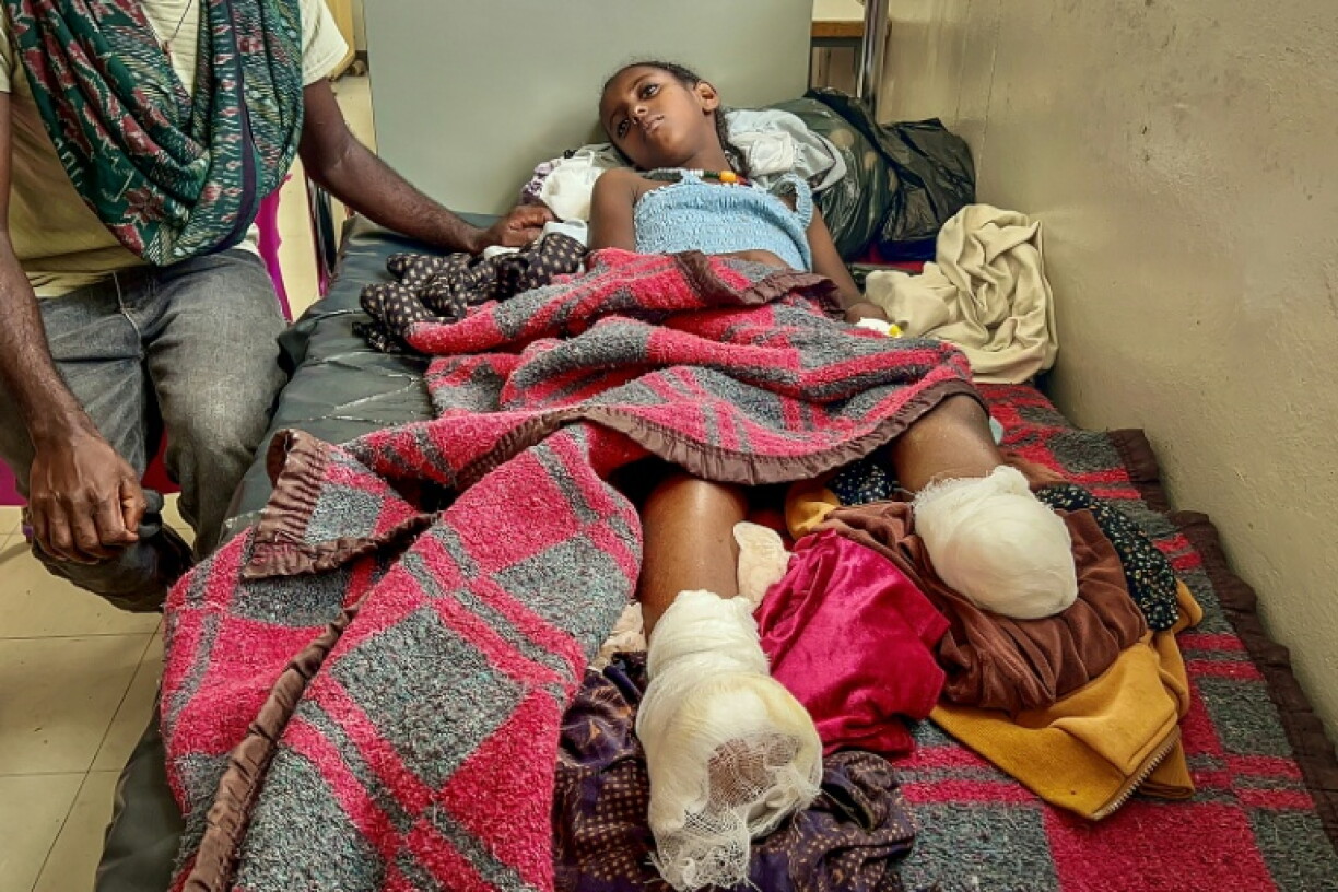 Iyerusalem, 10, needed both legs amputated after heavy shelling in Qarsole, Tigray, that also killed her brother