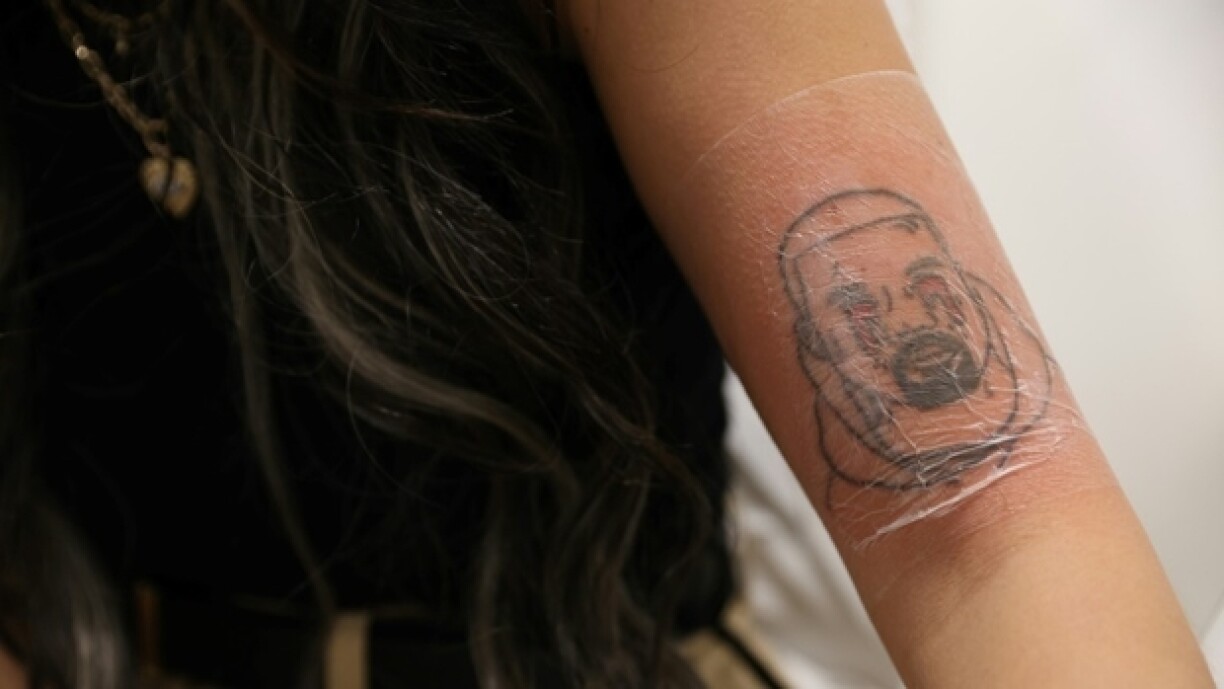 Kimberly Westgarth aux NAAMA Studios, une clinique de détatouage de Marylebone à Londres, le 14 décembre 2022