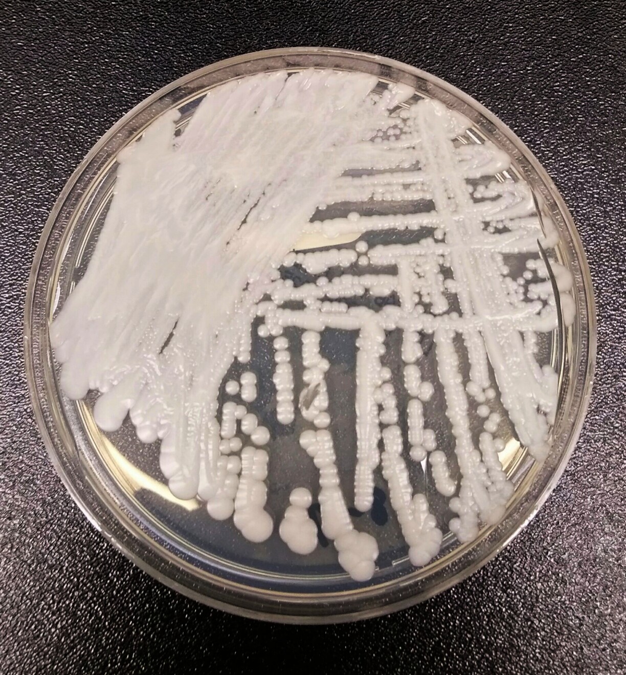 Un exemple de Candida Auris dans un laboratoire des CDC aux États-Unis