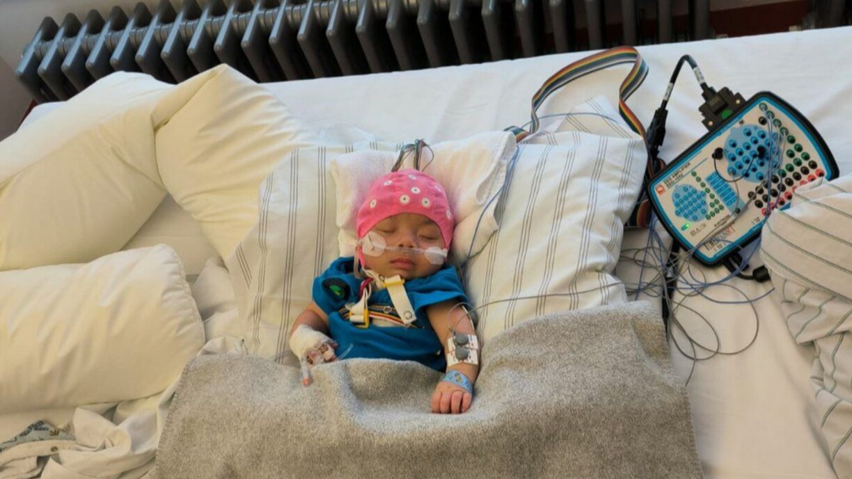 Baby Timo has been diagnosed with WWOX syndrome at only two months old.