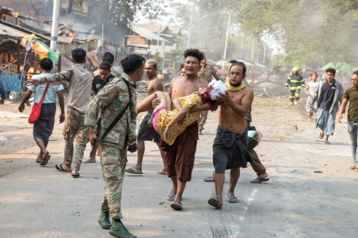 An injured civilian being carried following aerial bombardment of Singu in central Myanmar's Mandalay region