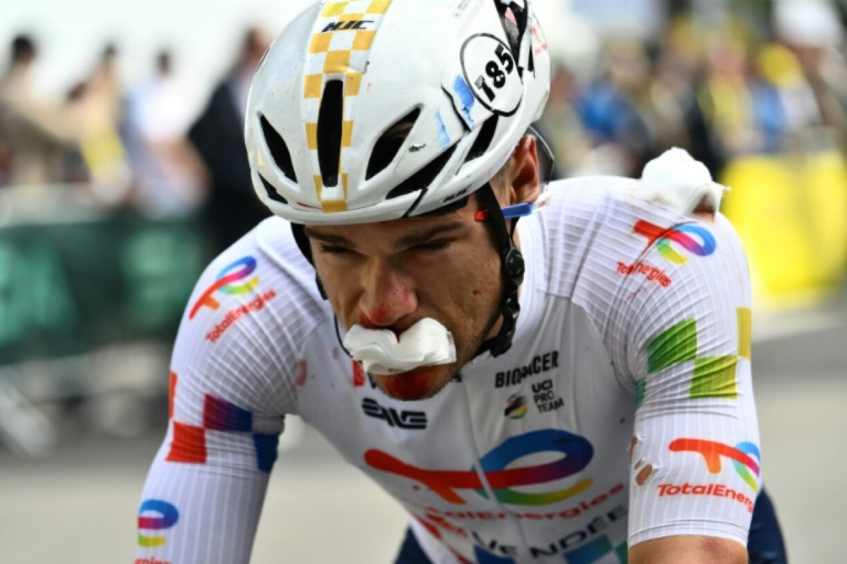 Emilien Jeanniere crossed the finish line on stage 3 of the Tour de France bandaged and bruised but went on to complete stage 4 as well before retiring on Wednesday