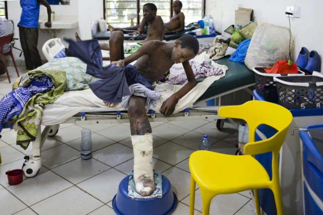 Shukurani Konde Tuva, 14, will lose his leg from above the knee after a puff adder bite due to lack of adequate antivenom