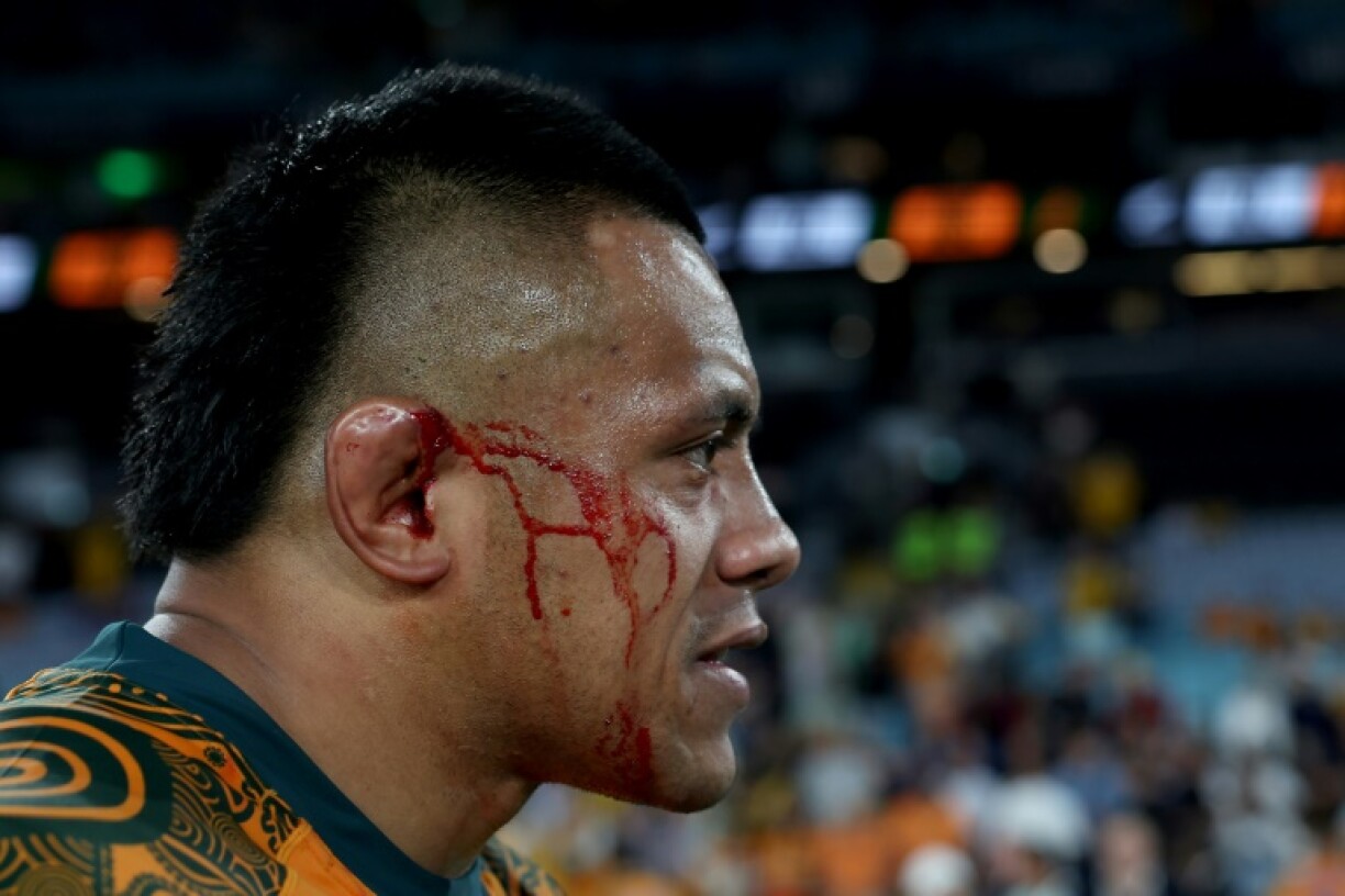 Australia prop Allan Alaalatoa has been ruled out of the third and final British and Irish Lions Test