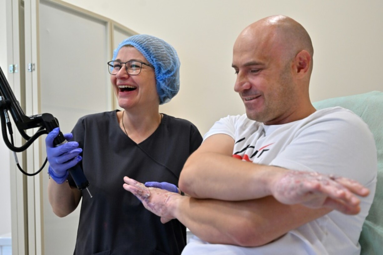 La dermatologue Kateryna Bezverchenko (g) soigne au laser Felix Rasko, volontaire engagé dans l'armée ukrainienne, aux mains brûlées, dans la clinique Choupeniouk à Kiev, le 25 juillet 2023