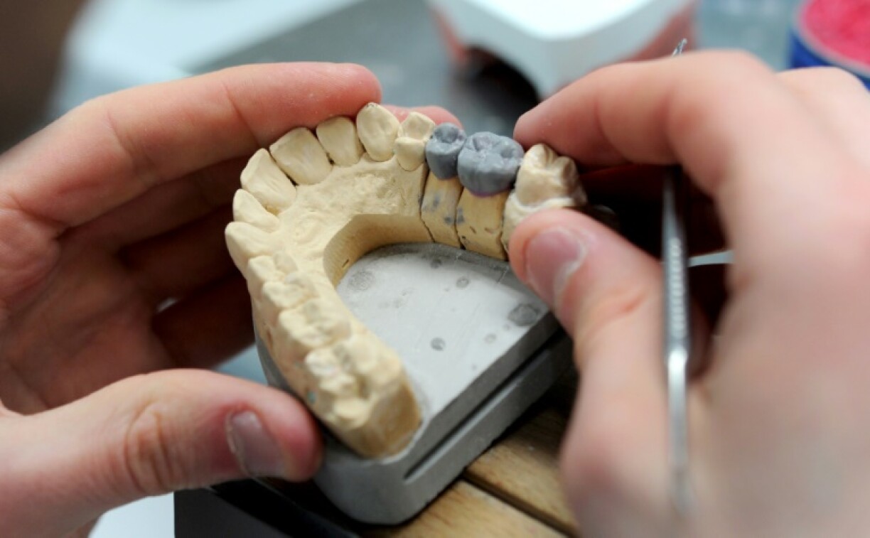 Un prothésiste travaille sur une dent en céramique. Parmi ce qui change au 1er avril: le plafonnement des prix de certaines prothèses dentaires