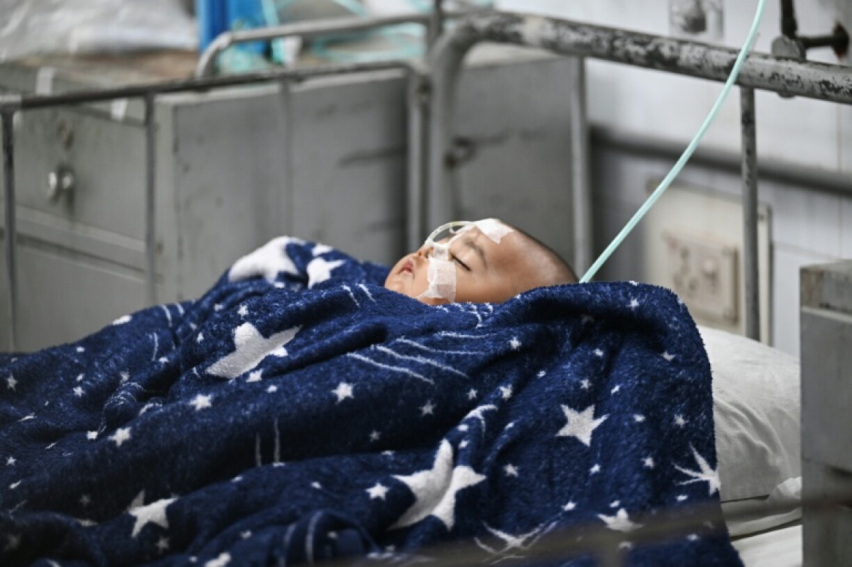 Un enfant reçoit un traitement contre la rougeole à l'hôpital Shishu, le 4 septembre 2026 à Dacca, au Bangladesh