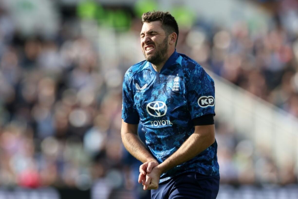 England's Jamie Overton