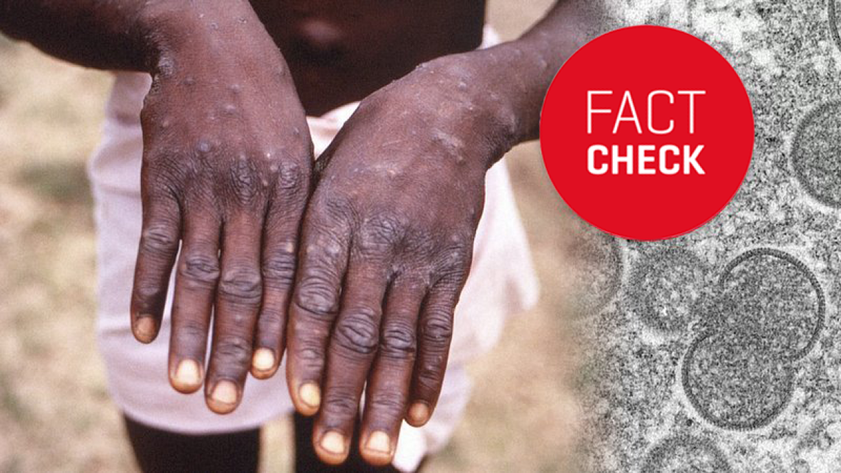 Does the virus stem from darker-skinned people? No! Skin tone has nothing to do with the transmission and risk of the virus.