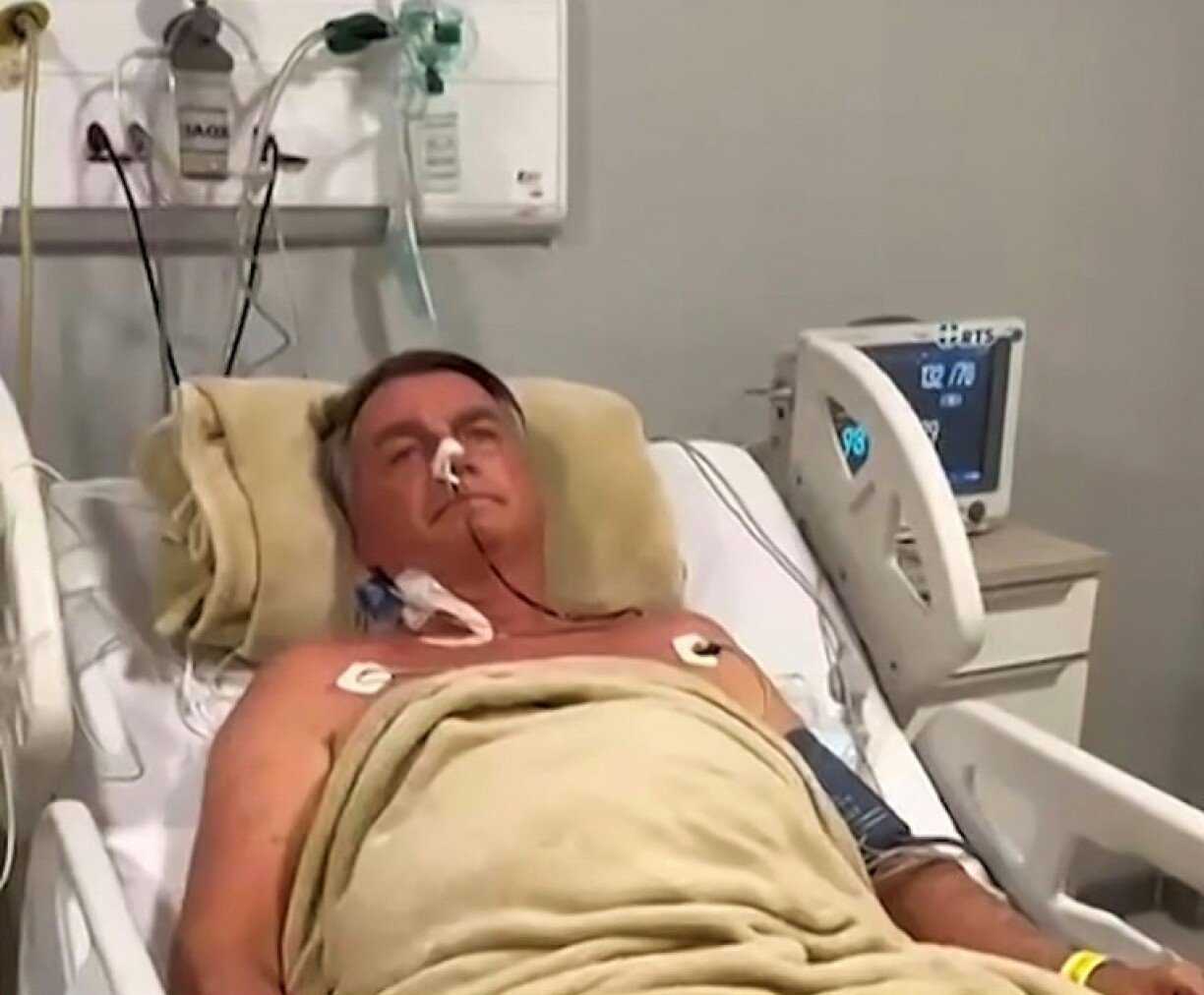 Jair Bolsonaro, Brazil's far-right former leader, said on X that he would 'probably be operated on again'