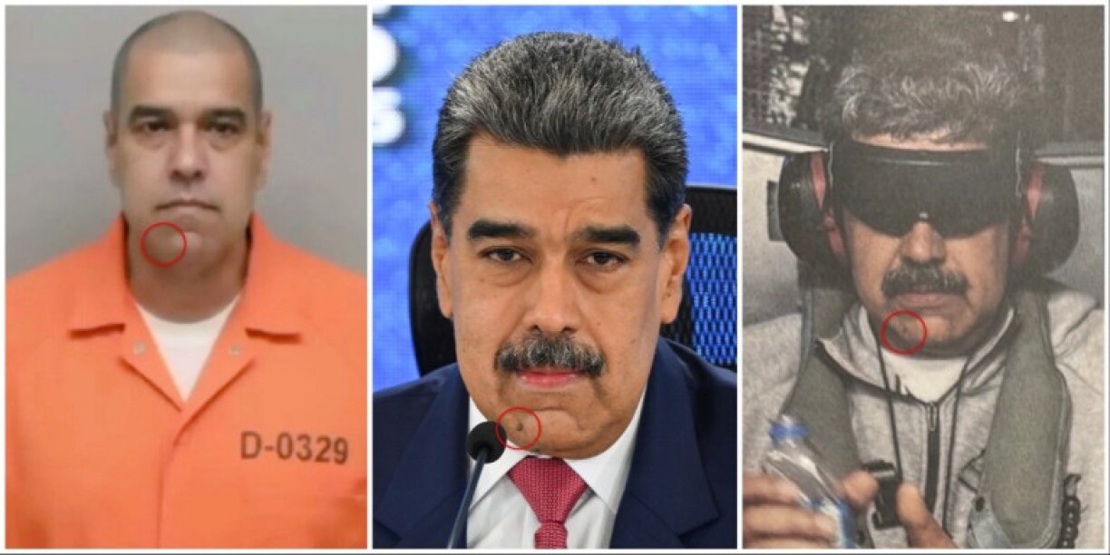 Comparison of the AI image (L) and Maduro's pictures released by AFP and Trump respectively (C, R) with the mole highlighted by AFP
