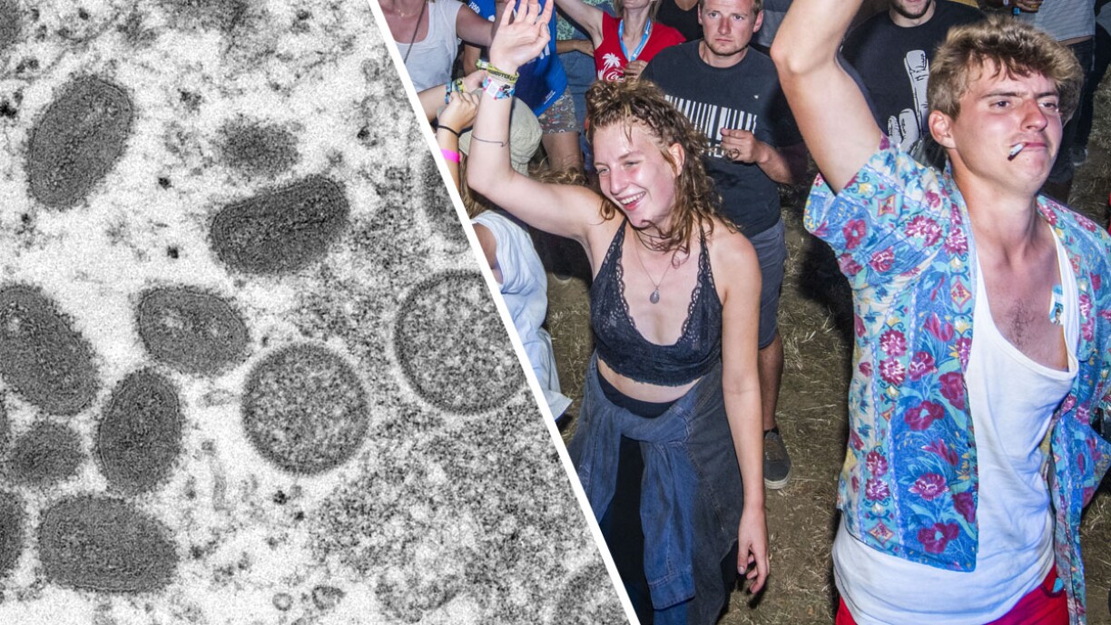 Variole du singe: l'OMS craint une propagation en Europe cet été à cause… des festivals
