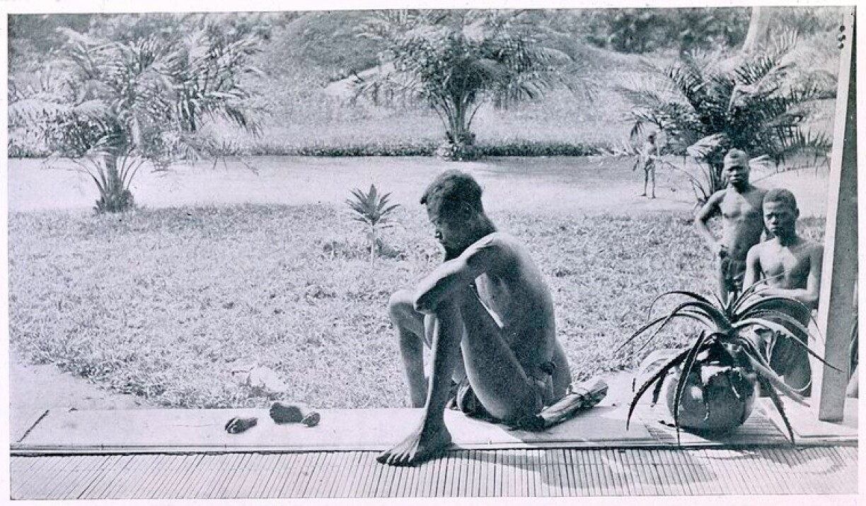 A father stares at the hand and foot of his five-year-old daughter, severed as a punishment for having harvested too little rubber.