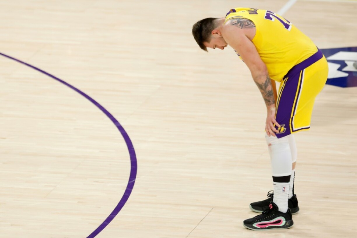 Luka Doncic led the Lakers with 28 points in a losing effort against Minnesota