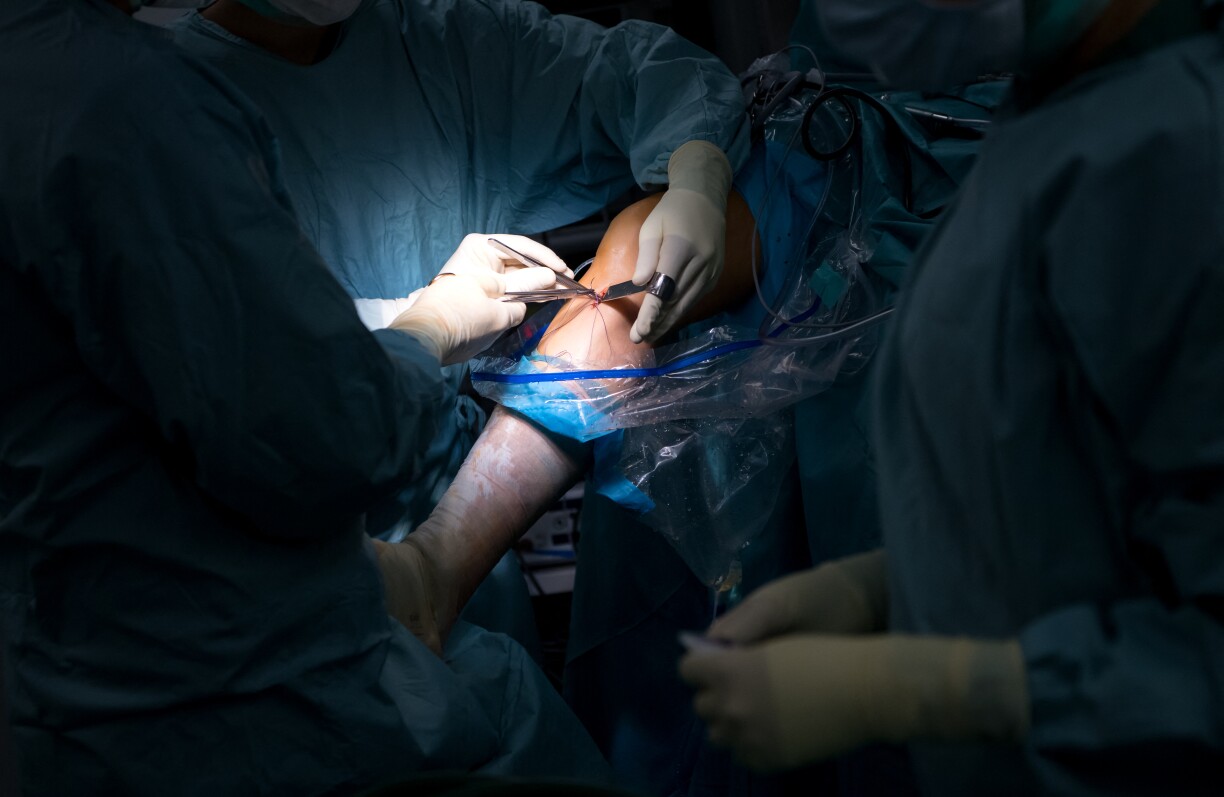 A doctor operating on a patient's knee in the Orthopedic Surgical Ward Munich (OCM) on 19 July 2018.