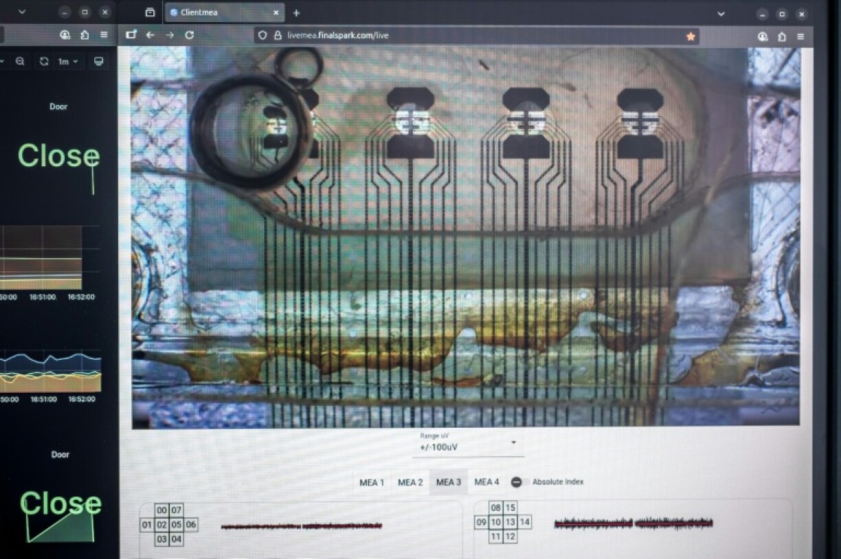 A screen showing the activity of the neurons, which is also displayed on the company's website