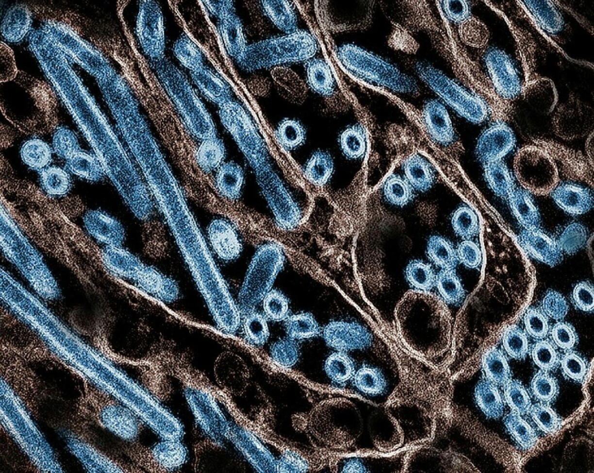 A colorized transmission electron micrograph of avian influenza A H5N1 virus particles (blue), grown in Madin-Darby Canine Kidney (MDCK) epithelial cells
