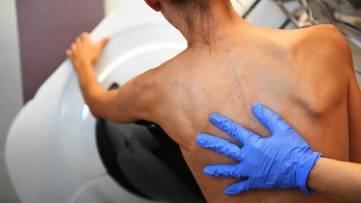 Eng Fra bei enger Mammographie