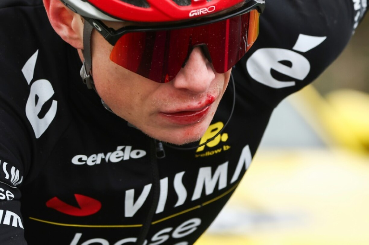 Jonas Vingegaard had more than a bloodied lip to show for his crash during the fifth stage of the Paris-Nice