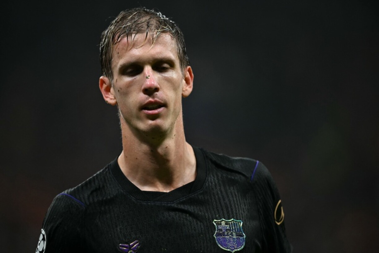 Barcelona's Dani Olmo will be out for a month with a left thigh injury