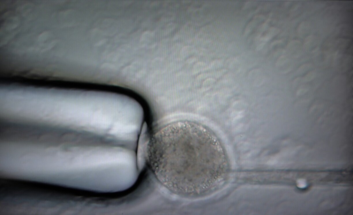 DNA is removed from an oocyte before being injected with genetic modifications at the Revivicor Laboratories, in Blacksburg, Virginia, on November 22, 2024