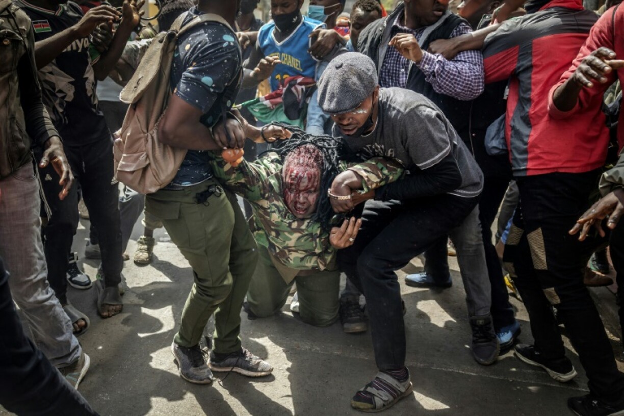 Protesters assisted an injured police officer
