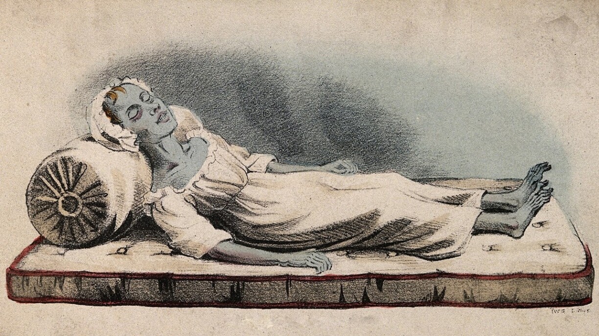Cholera illustration. Cholera was also called the