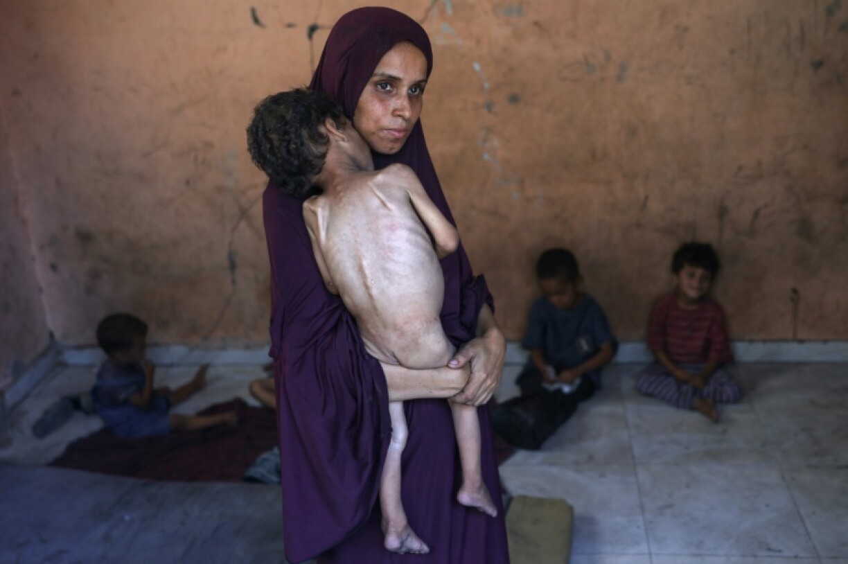 Naeema, a Palestinian mother, carries her malnourished two-year-old son Yazan as they stand in their damaged home in the Al-Shati refugee camp in Gaza City