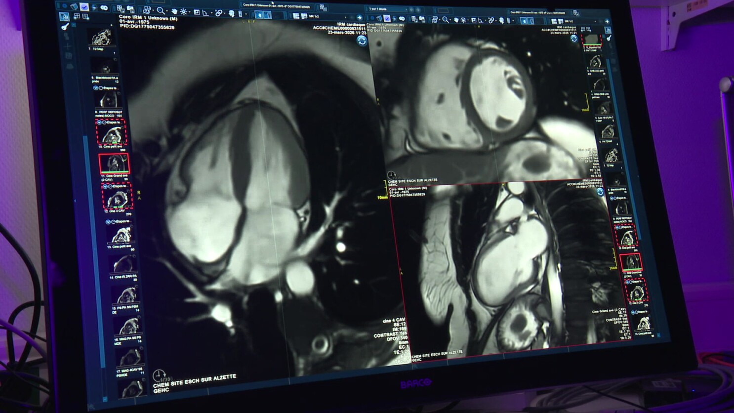 CHEM recognised as reference centre for cardiac imaging in Luxembourg and Greater Region