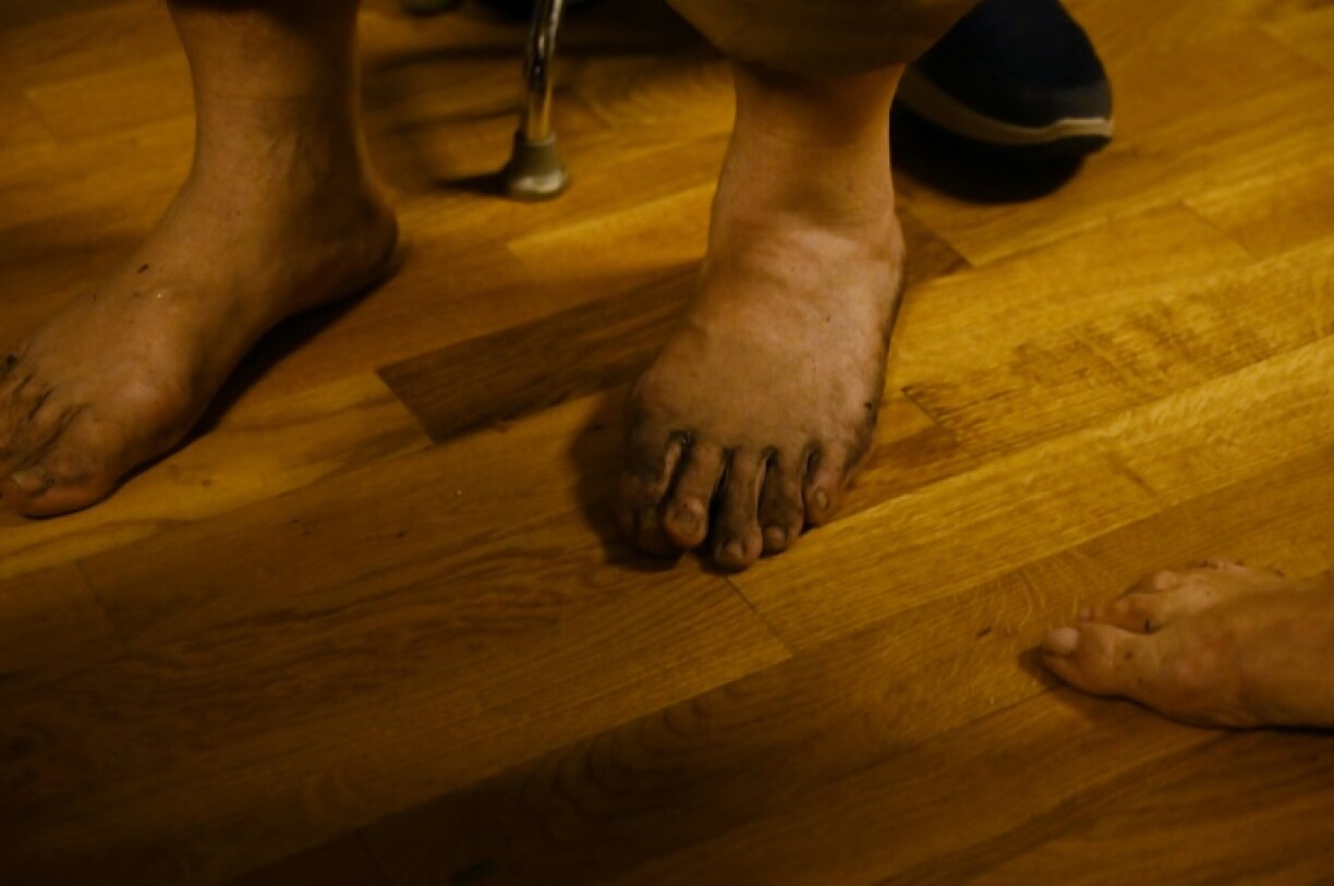 Fire walkers display their feet after the ritual, showing they have no burns -- proof of a miracle, believers say