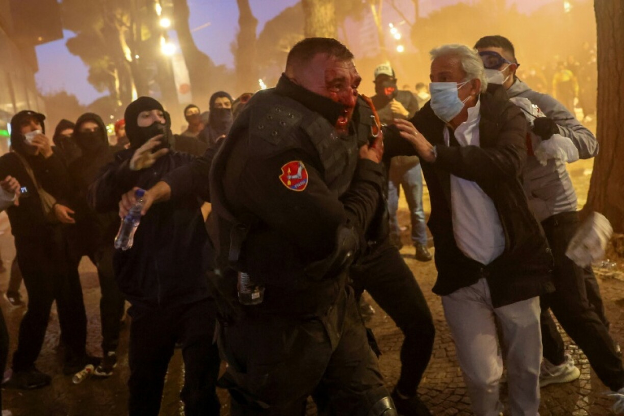 Police said officers were hurt, while Tirana hospital said injured protestors had sought medical treatment