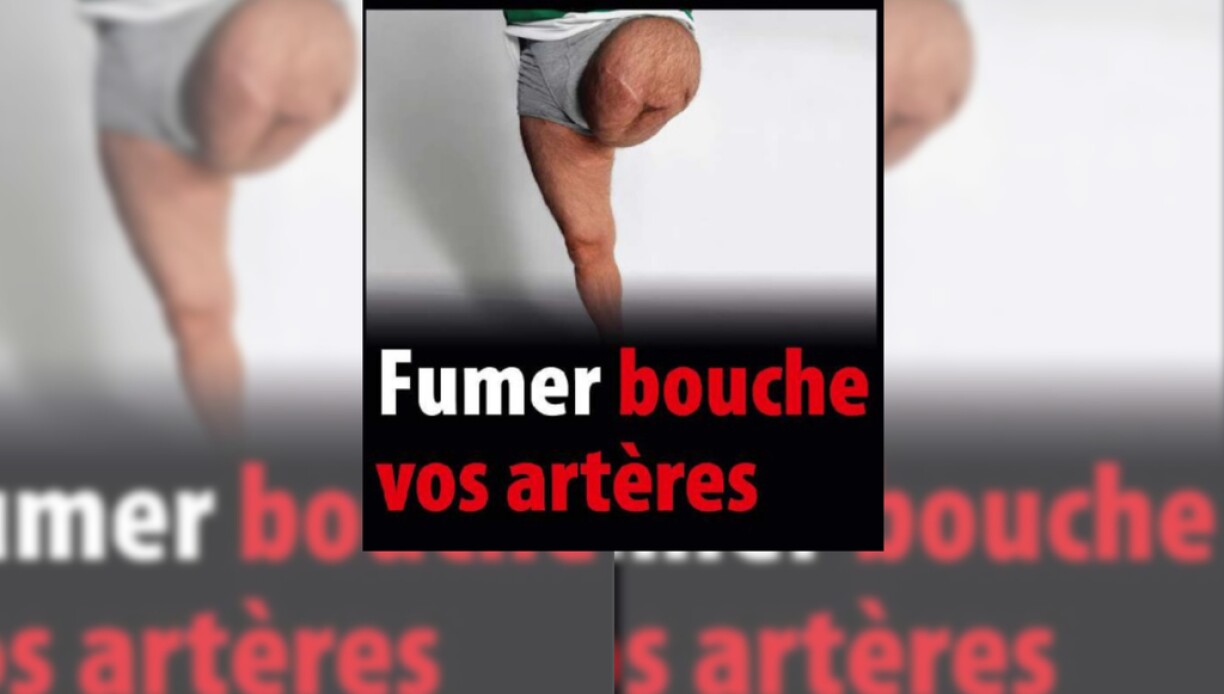 Contrairement à ce qu'il avançait, la photo d'un patient de l'hôpital Legouest pourrait ne pas avoir été prise au sein de l'établissement militaire.