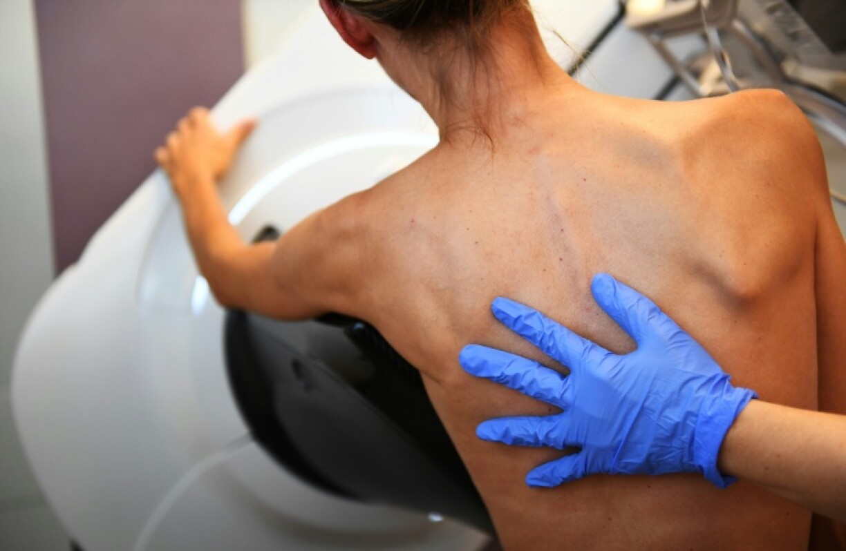 Une patiente passe une mammographie le 9 octobre 2017, à l'institut Paoli-Calmette, à Marseille