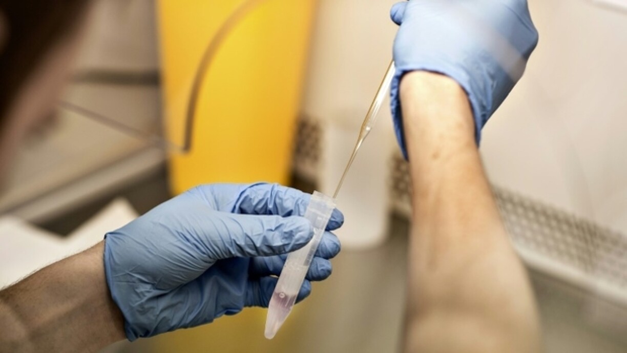 Eng Spermaprouf an enger Samenbank.